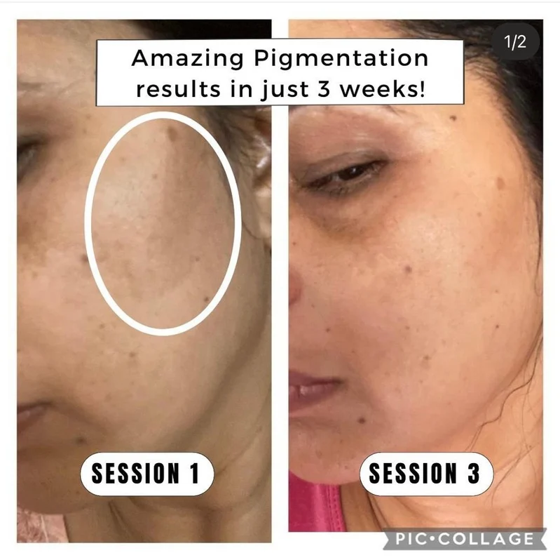 Face Yoga client transformation 1