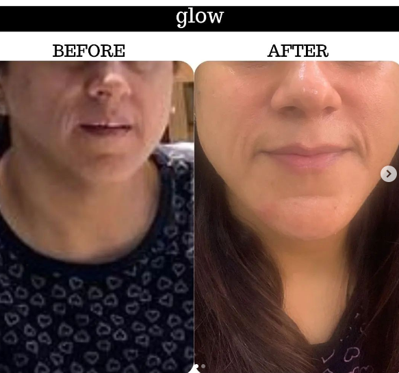 Face Yoga client transformation 3