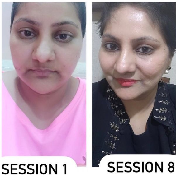 Face Yoga client transformation 4