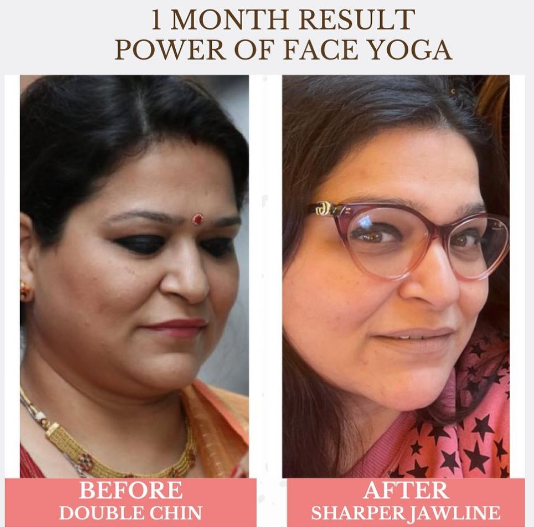 Face Yoga client transformation 5